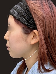 SBC岡山院・小顔メニューのご案内