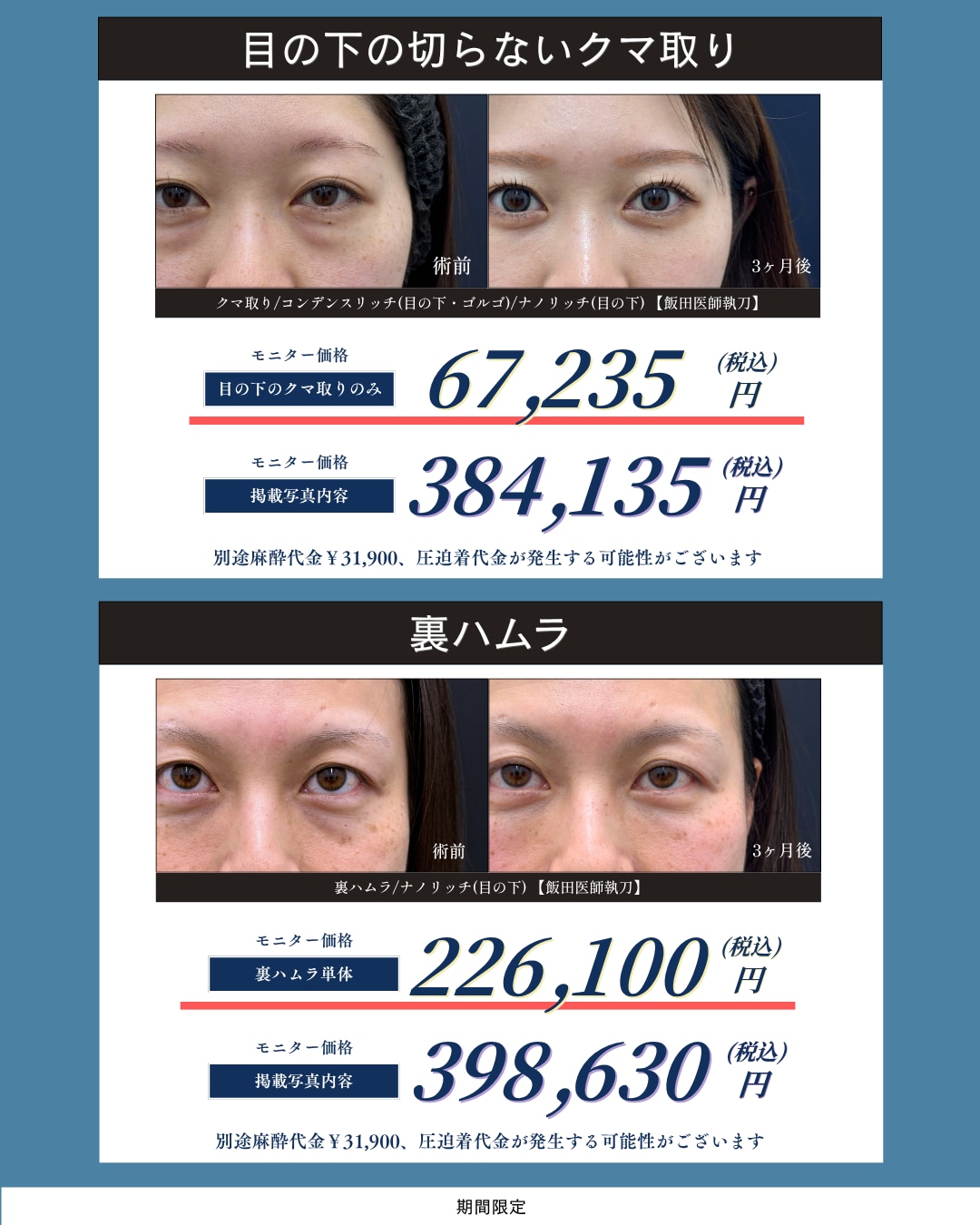 10月31日までの<span style="color: #FF3C82"><b>【クマ取り・裏ハムラ】</b></span>の料金一覧