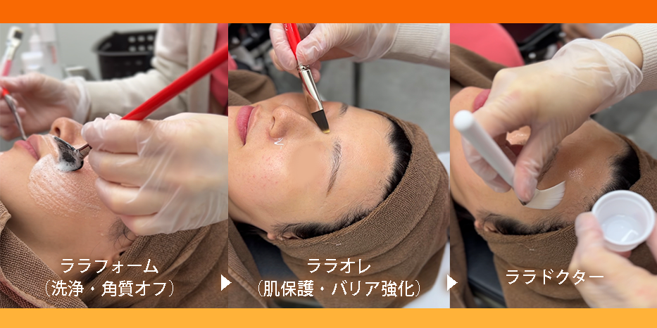 従来のピーリングとの違い