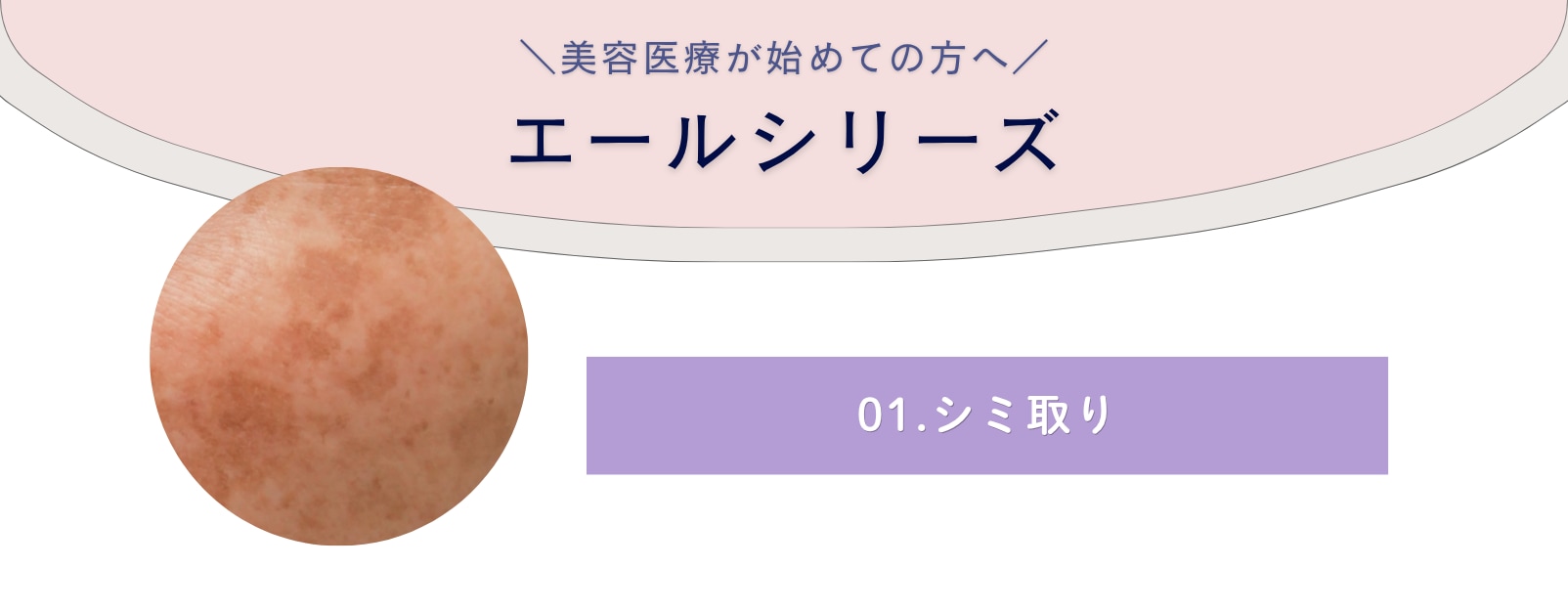 シミ取りレーザー
