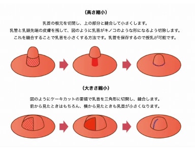 気になる大きさ・形を整えます!