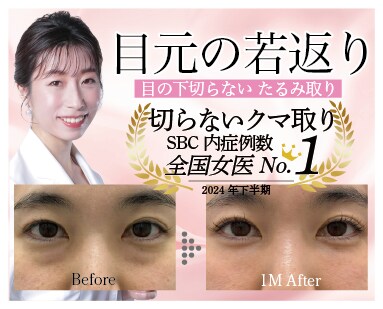 埼玉 大宮でクマ取りするなら【東日本女医no.1（2024年下半期SBC内）】切らないクマ取り カリスマ女医 完山医師にお任せください♡