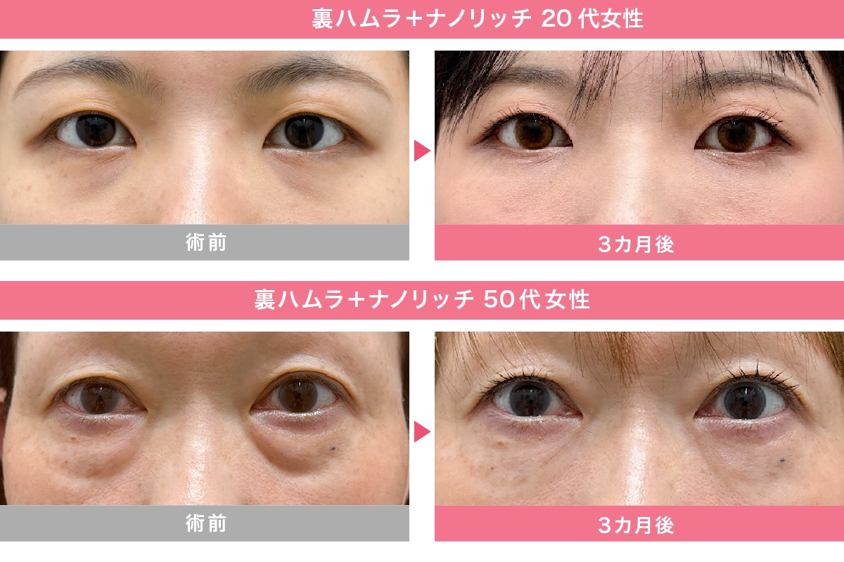 幅広い年齢層のお客様から指名をいただいています！