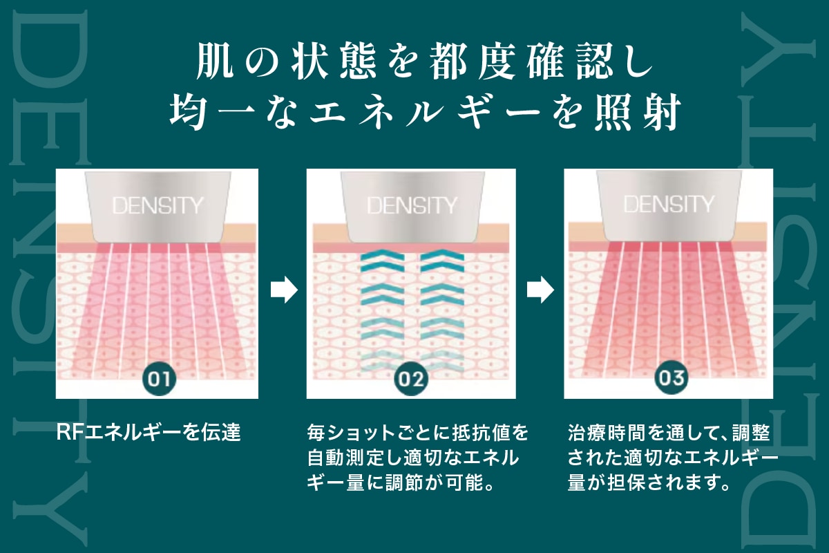 自動測定により正確で均一なエネルギーを照射