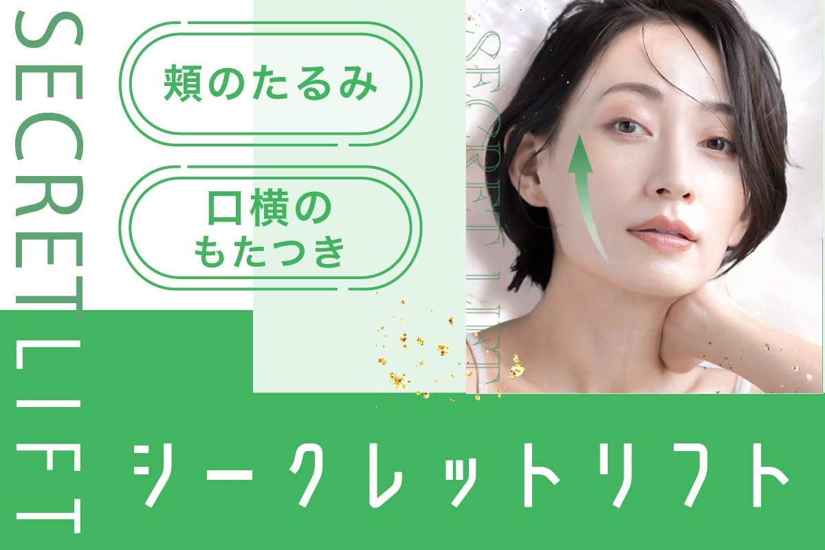 シークレットリフト