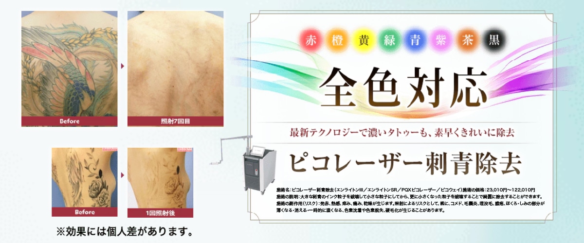 全カラー対応！あらゆるタイプのタトゥーに効果的