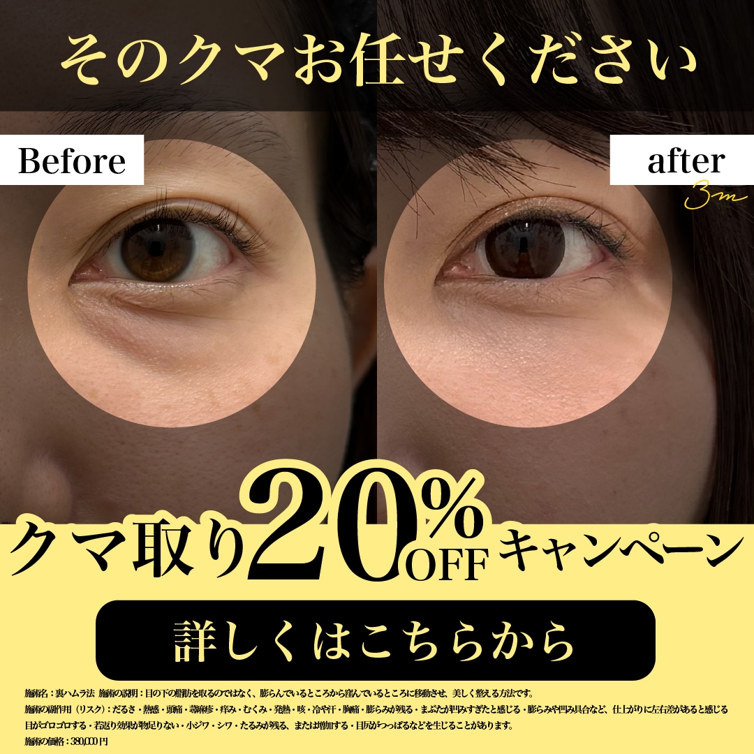 クマ取りキャンペーン2月