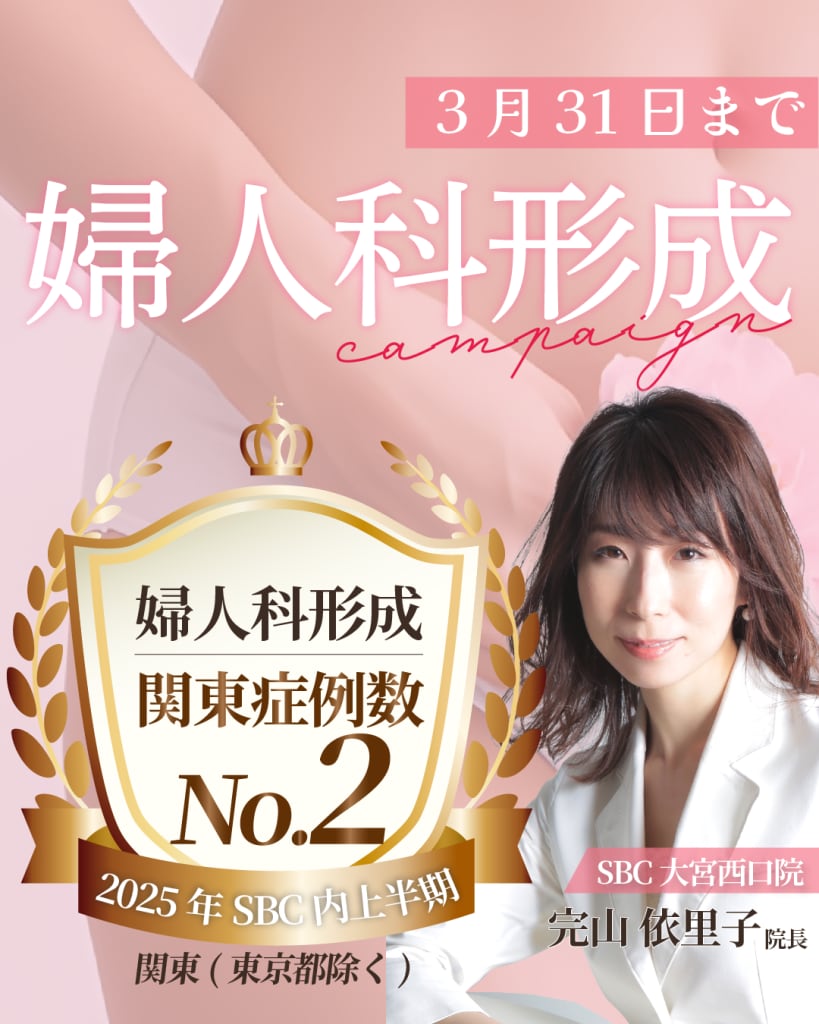 婦人科形成イメージ