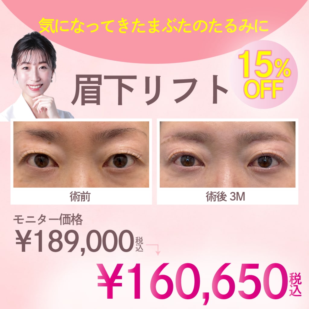 眉下リフトキャンペーンTOP
