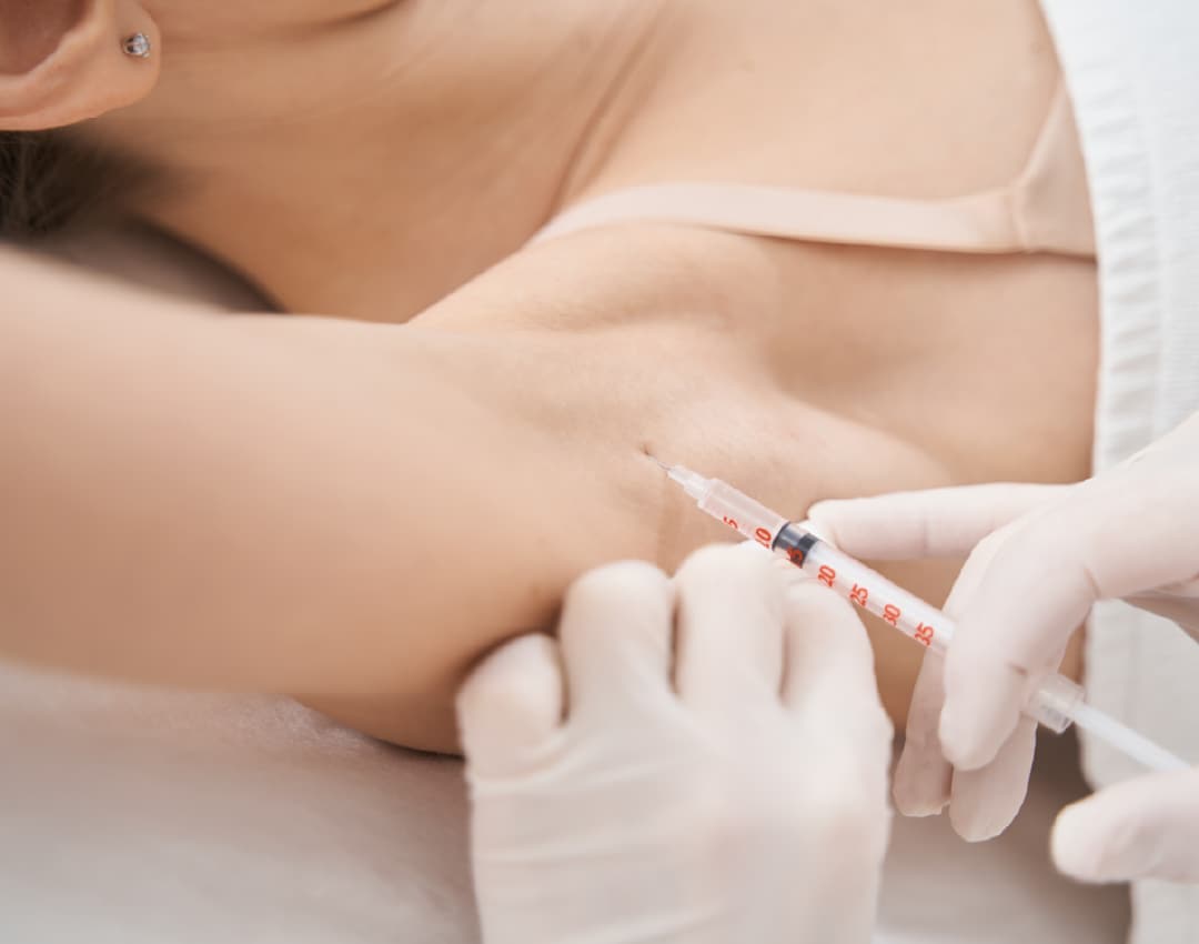 ボトックスが汗の悩みを解消する仕組み