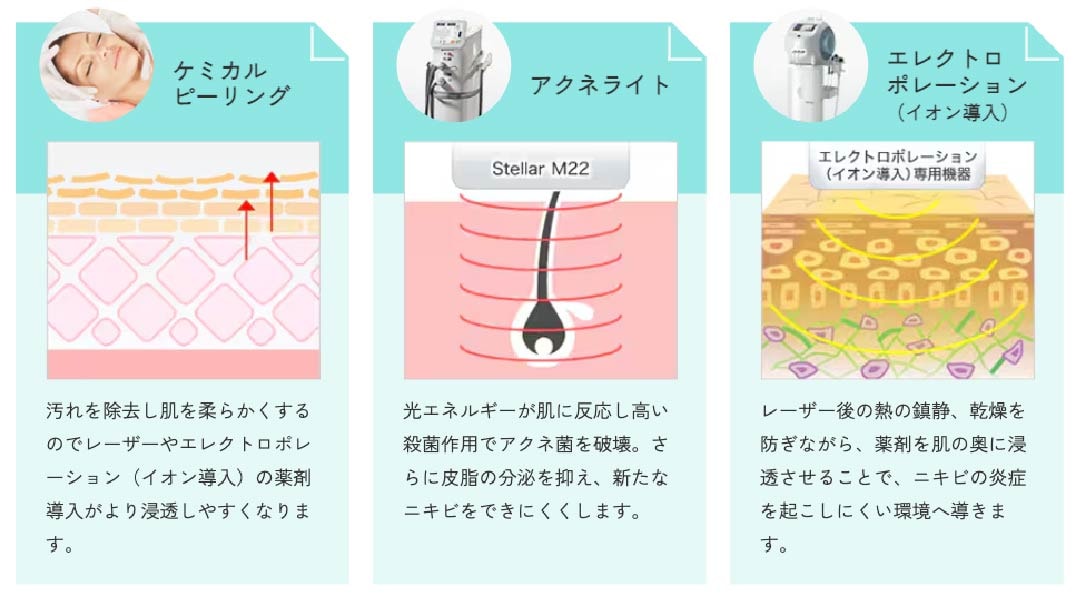 ピーリング