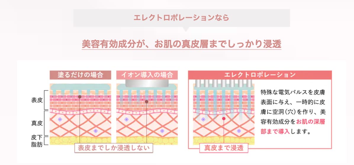 エレクトロポレーション（イオン導入）
