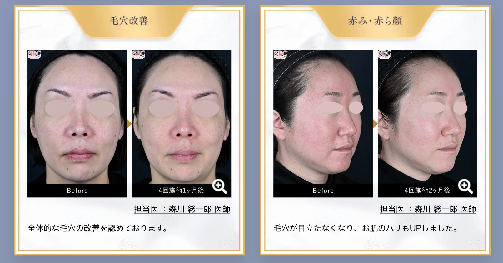 シルファーム症例写真