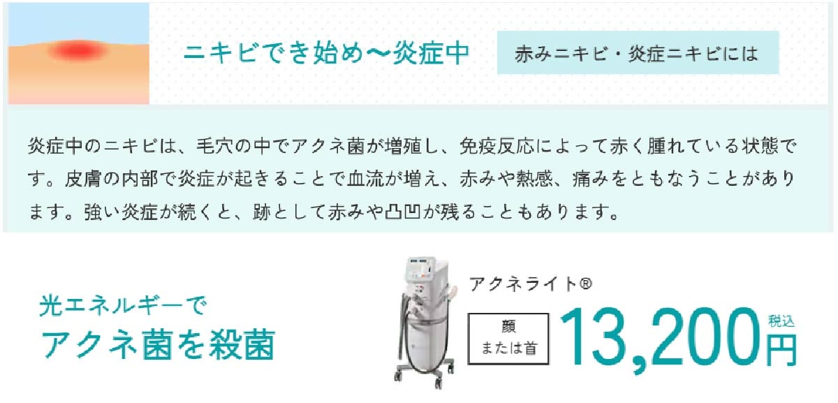 ニキビの原因へアプローチ