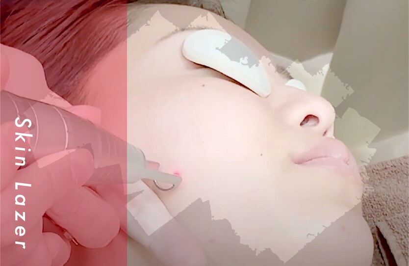 【美容皮膚科】予算別！お手軽美肌メニューまとめました♡