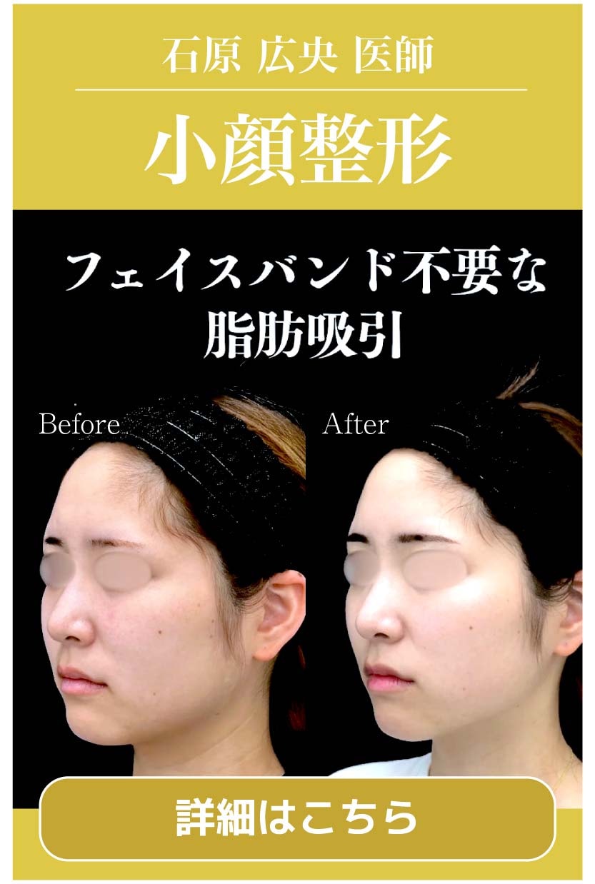 【小顔】輪郭整形なら石原医師にお任せ！