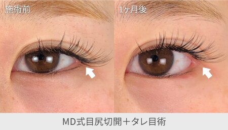 横に大きく | キツい目元が悩みのあなたに。