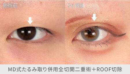 縦に大きく | 重たい一重のあなたに。