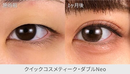 一番人気 | とにかくバレたくないあなたに。