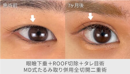 縦に大きく | 眠いの?って聞かれがちなあなたに。