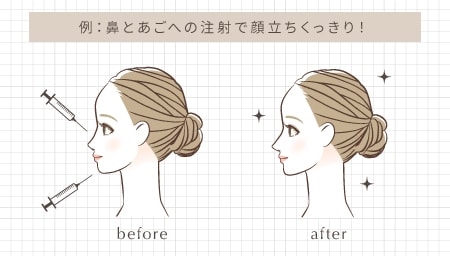 形を整えてもっと可愛く - 20~30代の方に人気です!