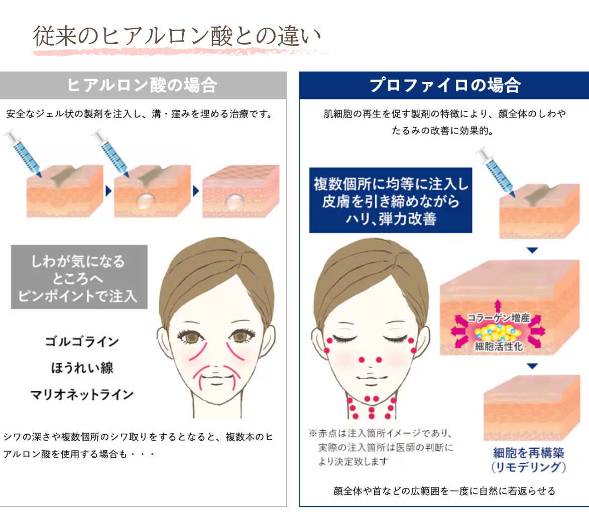 従来のヒアルロン酸