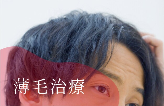薄毛治療
