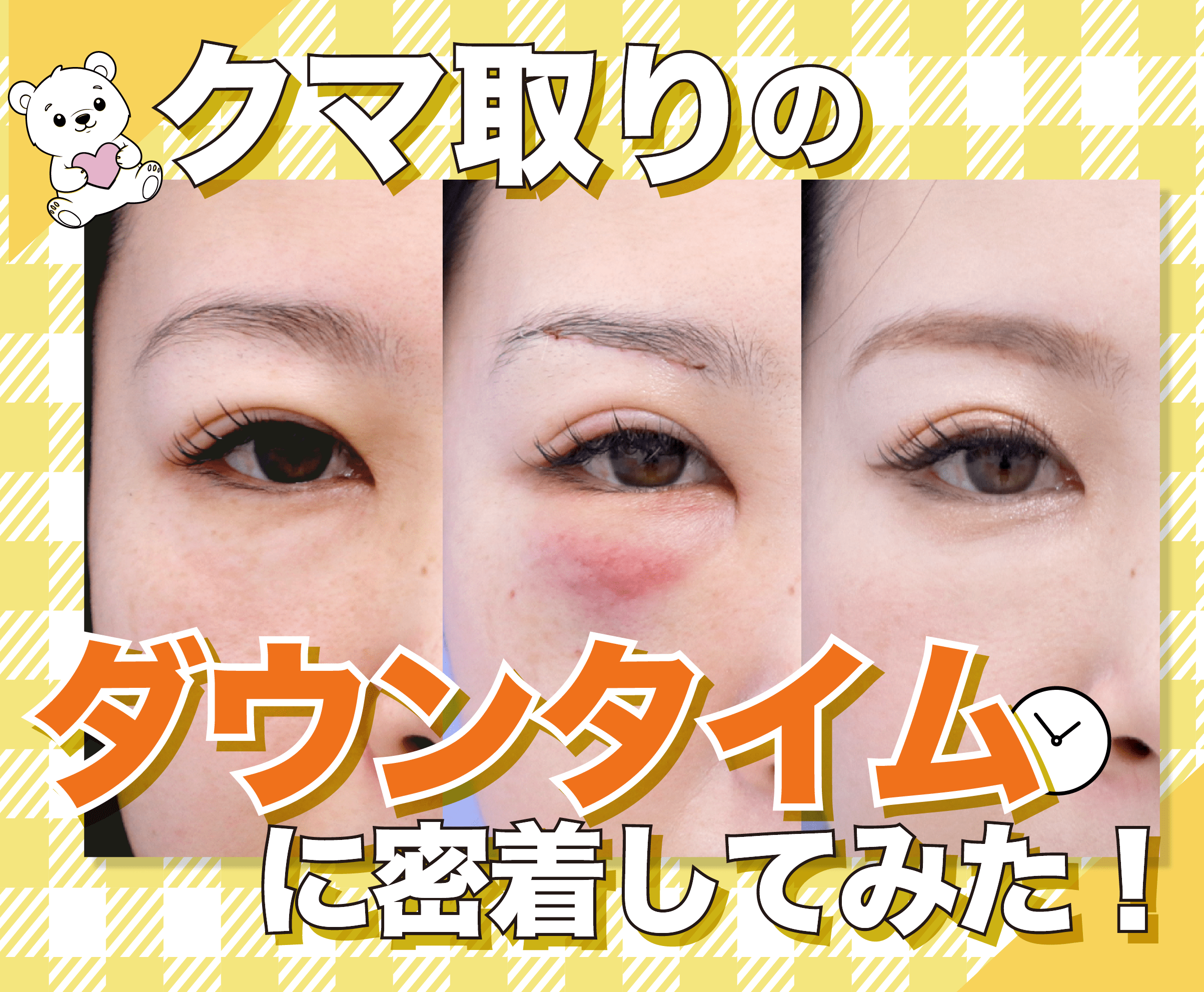 ダウン タイム と は