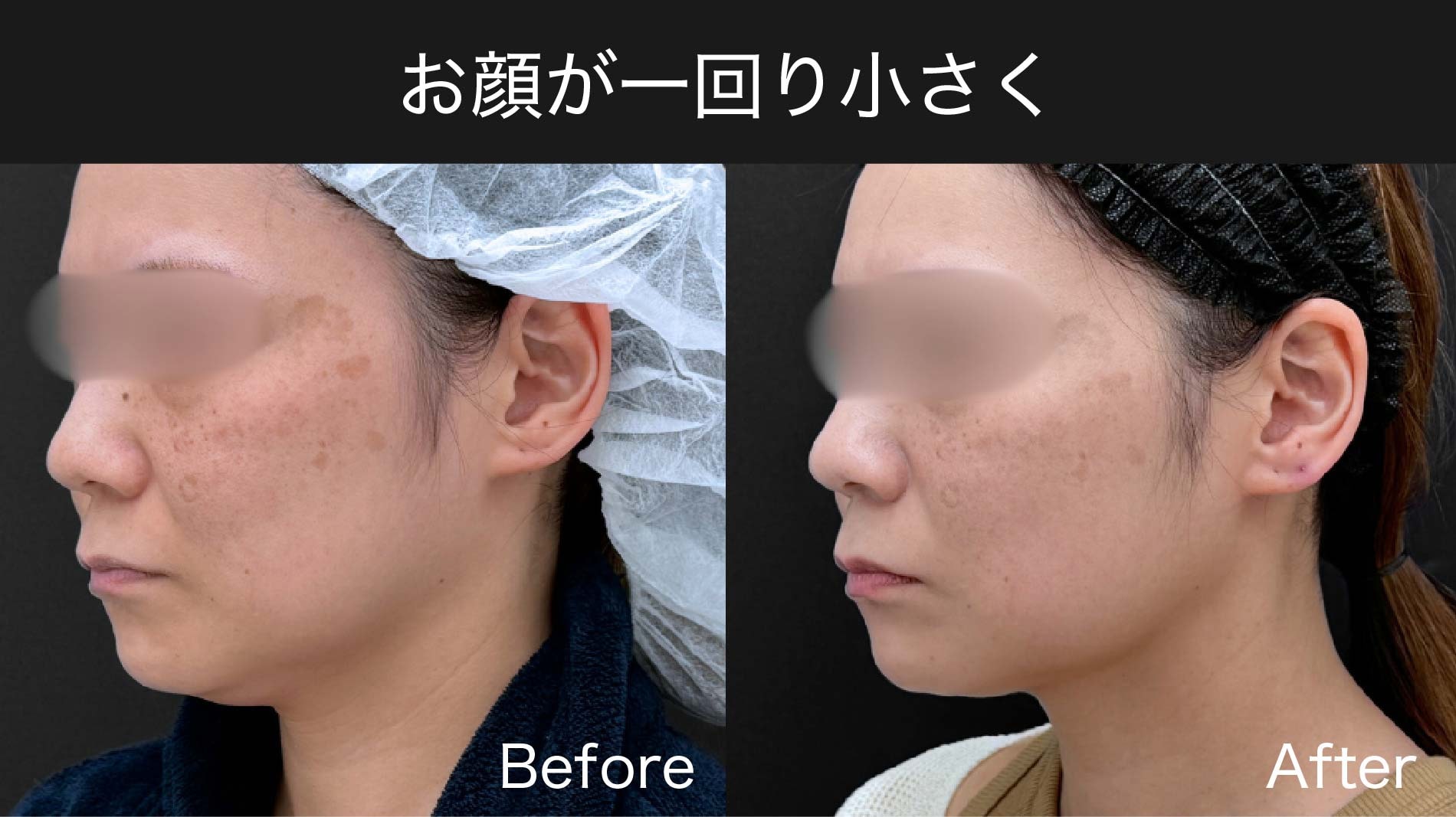 お顔が一回り小さく
