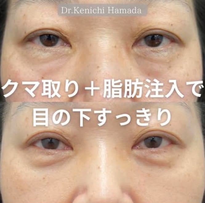 直後からこんなに綺麗！