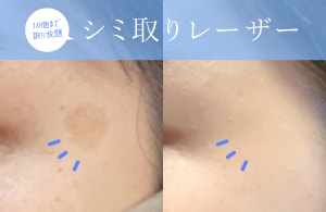 湘南美容外科　ダームエデン TXA濃縮美容液（ダームエデン）｜内服・外用薬・その他商品なら