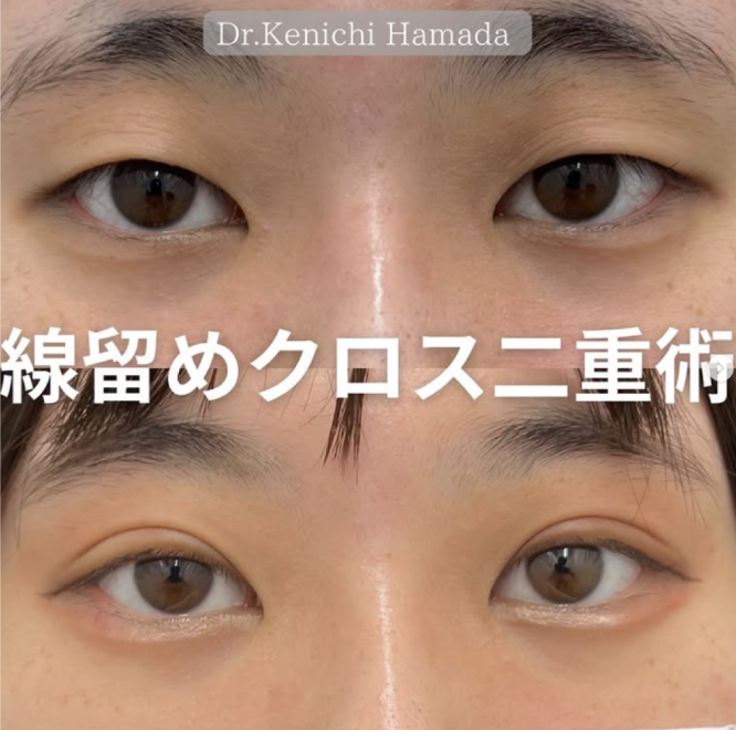 20代 症例写真