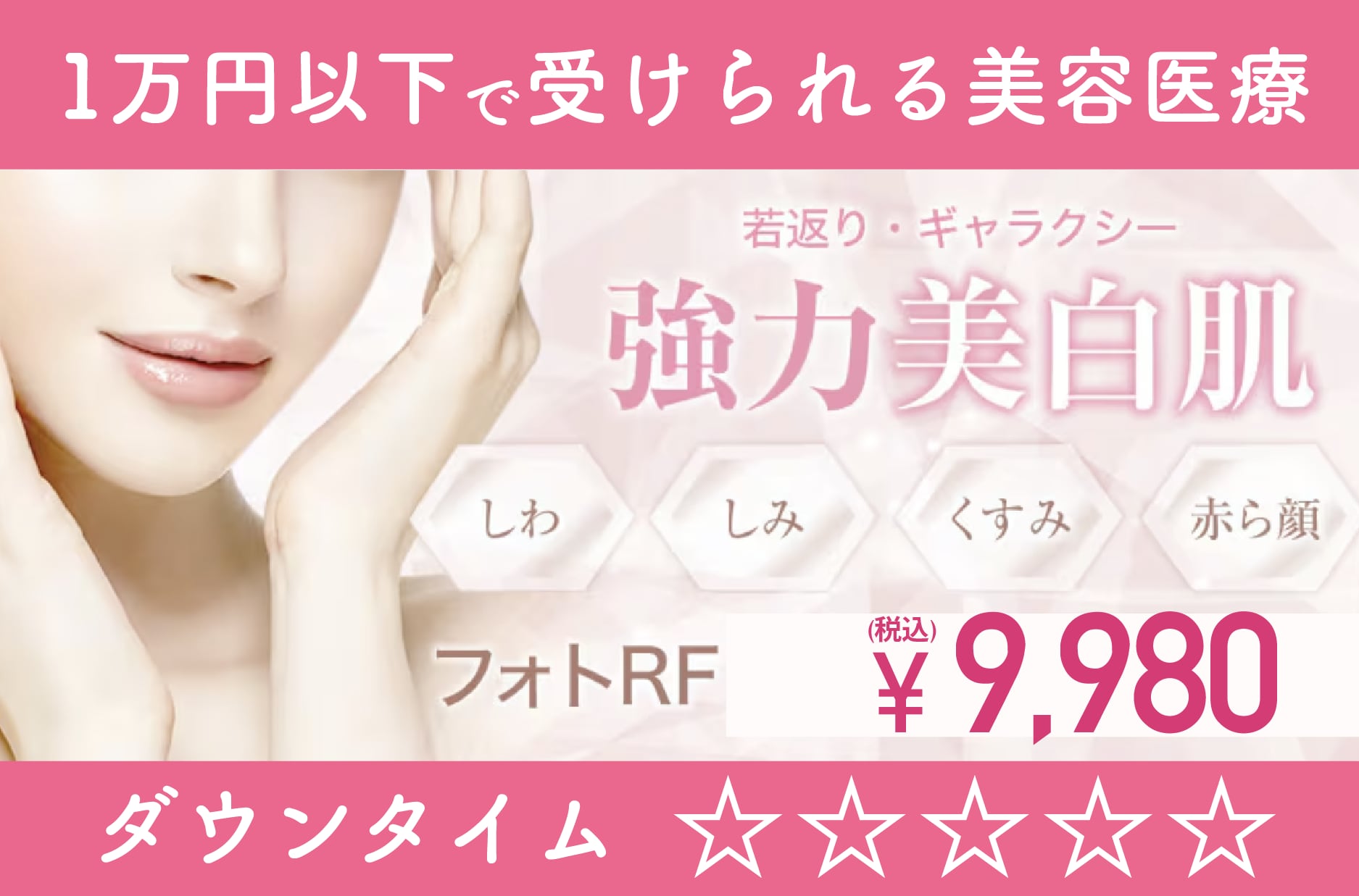 IPL光治療（フォトRF）