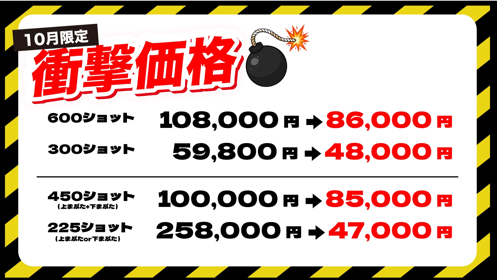 10月限定デンシティがお得に受けられる！