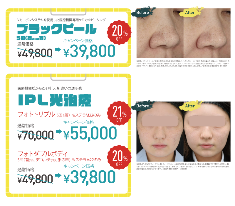 キャンペーン画像