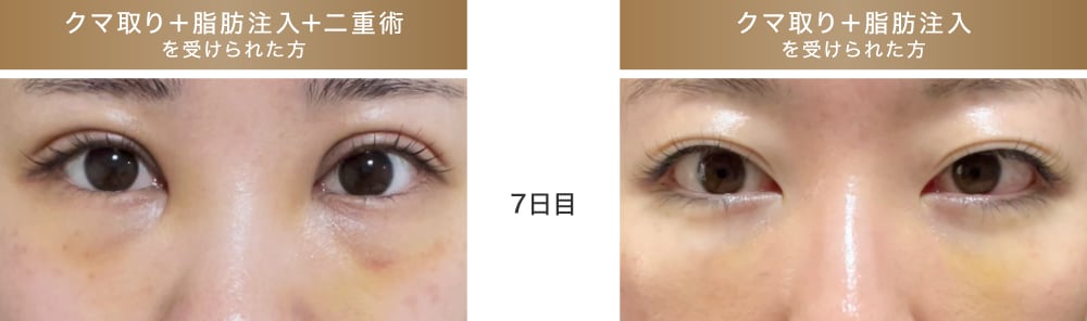 1週間後の経過