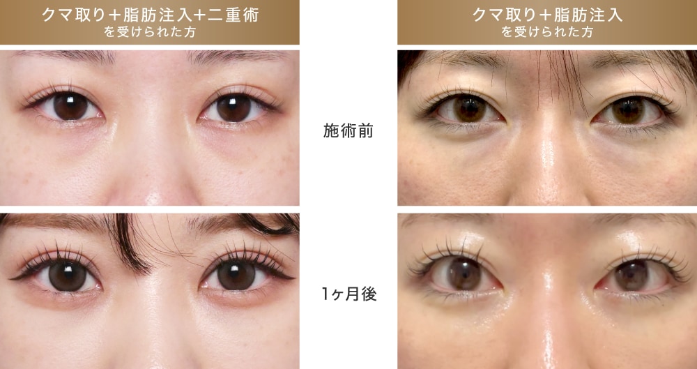 その後の経過