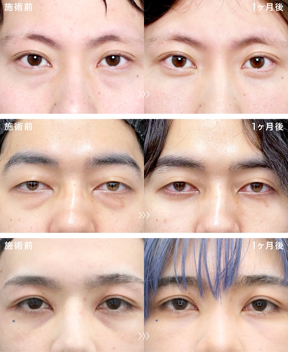 20代男性