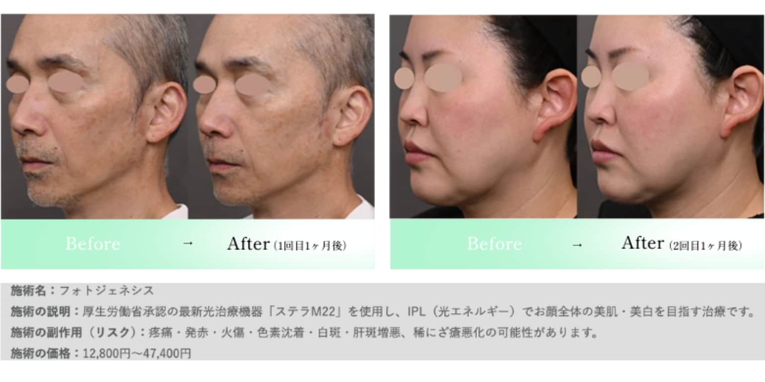 1回でも効果はある？推奨回数と頻度