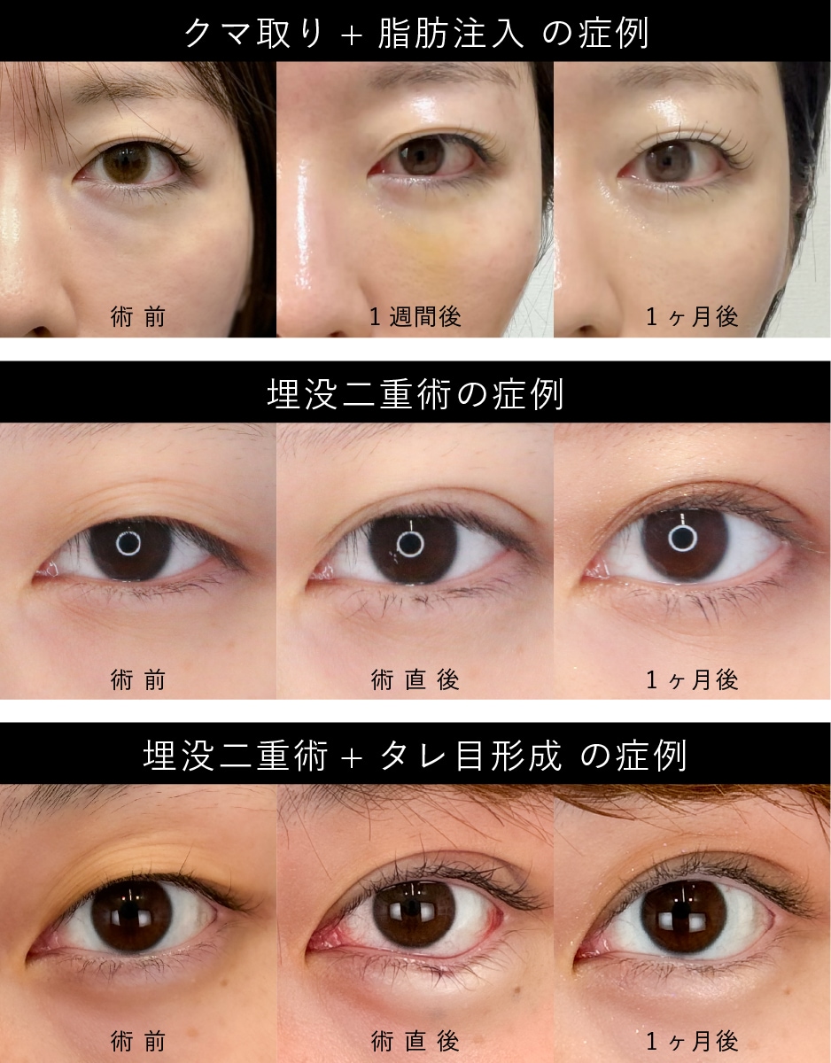 やりすぎない、整える整形