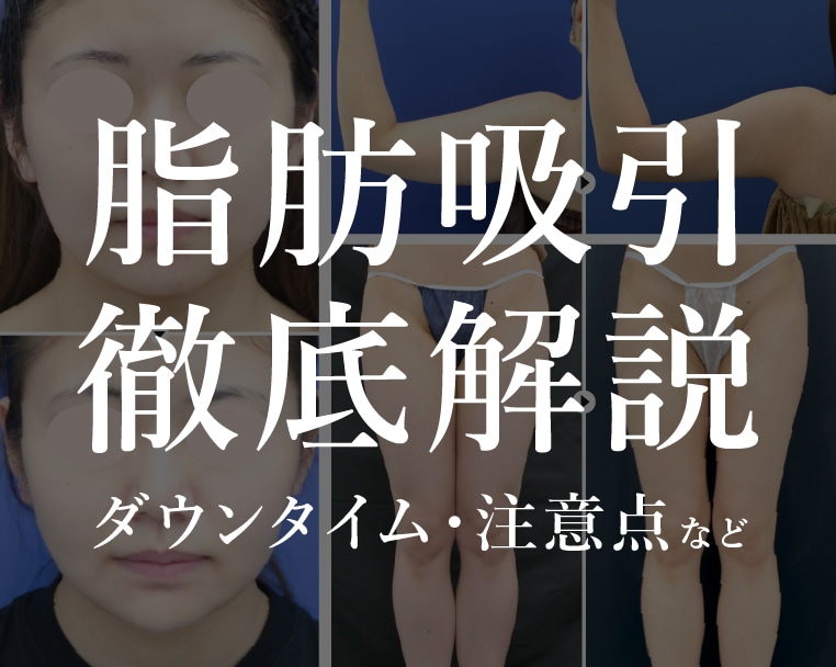 埼玉・大宮|脂肪吸引の症例・施術方法・ダウンタイムを徹底解説