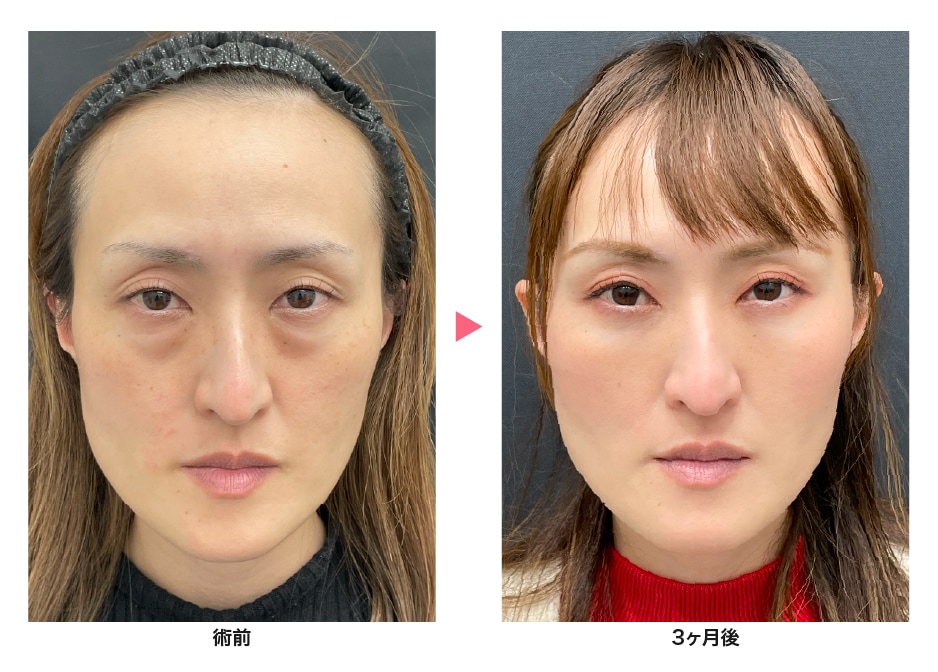 自然で美しい仕上がり