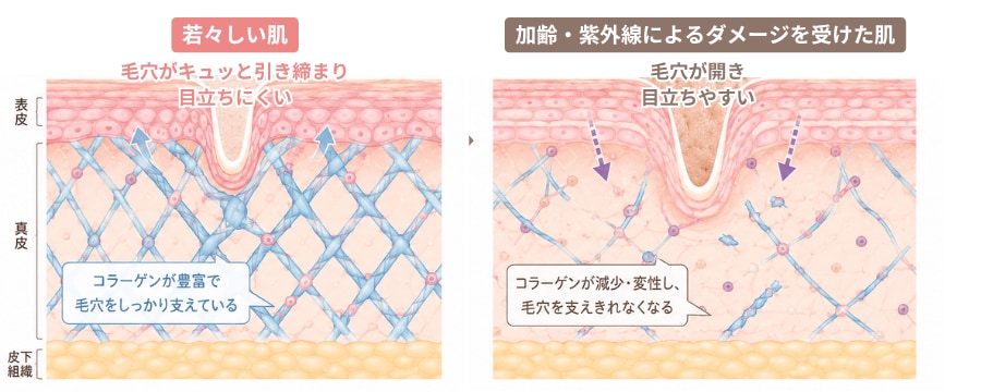 毛穴の開き・たるみの引き締め
