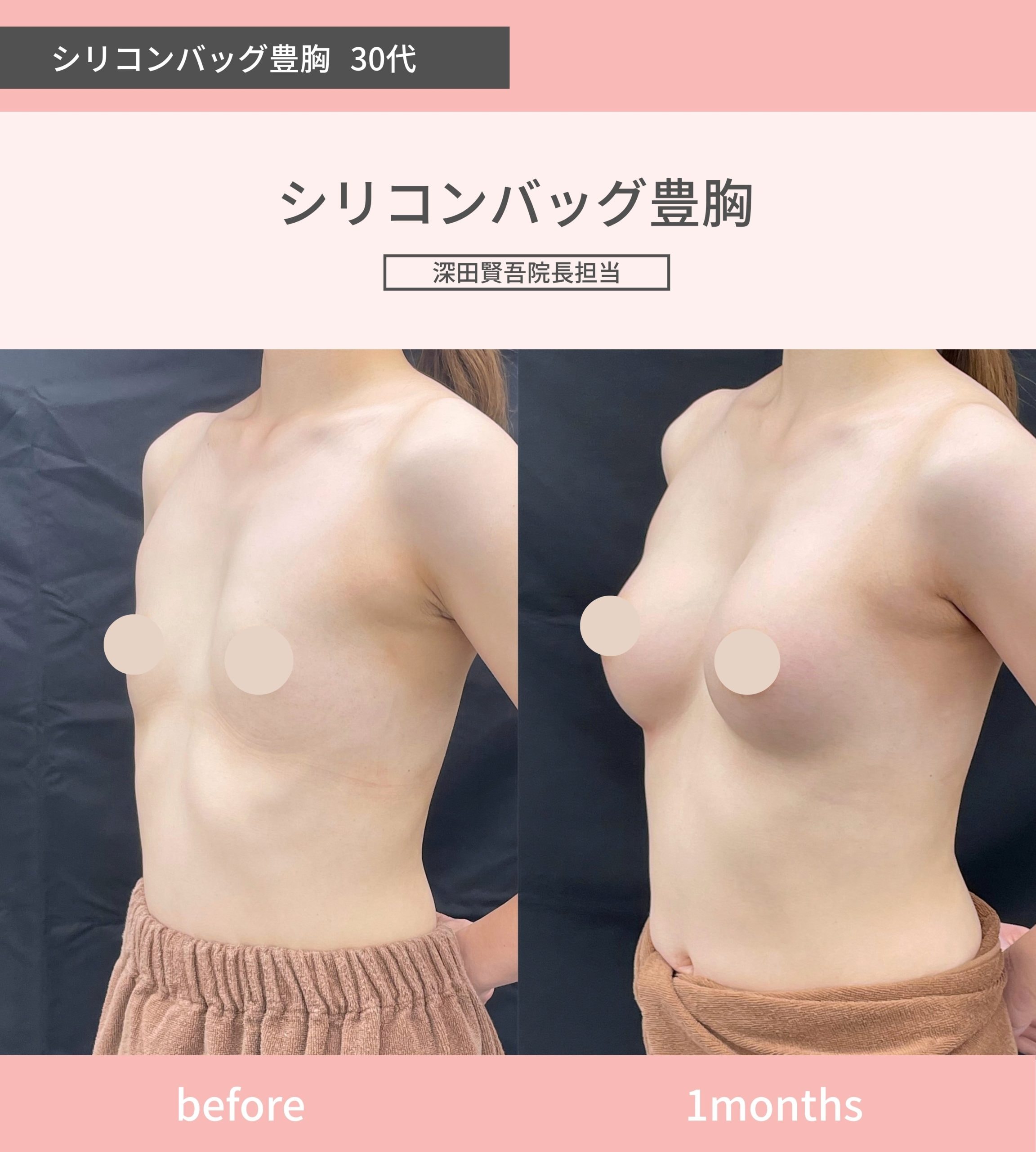確実なバストアップを目指すなら
