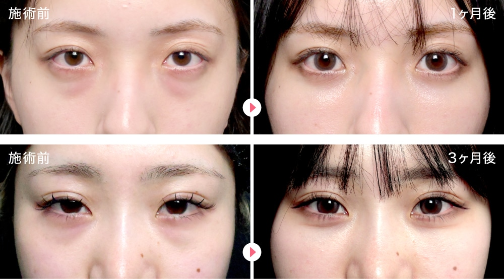 20代女性