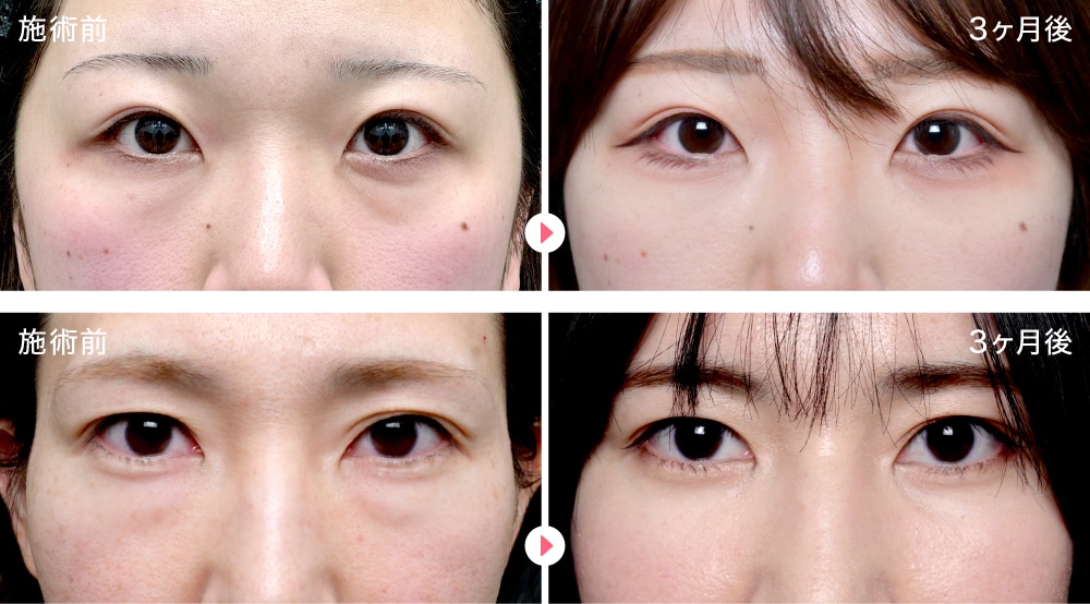 30代女性