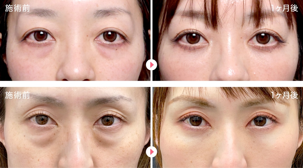 40代女性