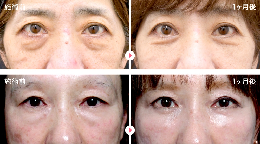 50代女性