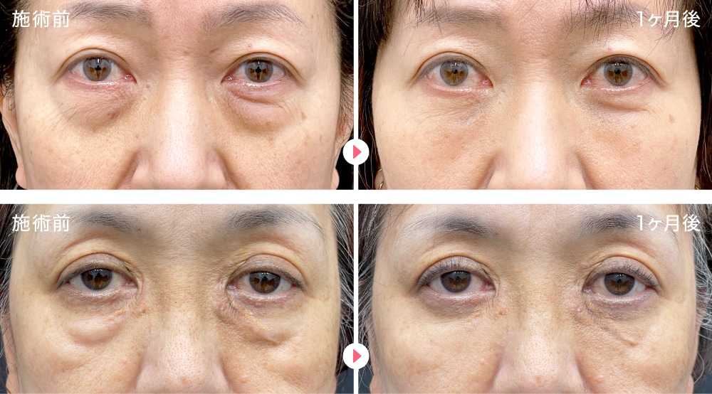 60代女性