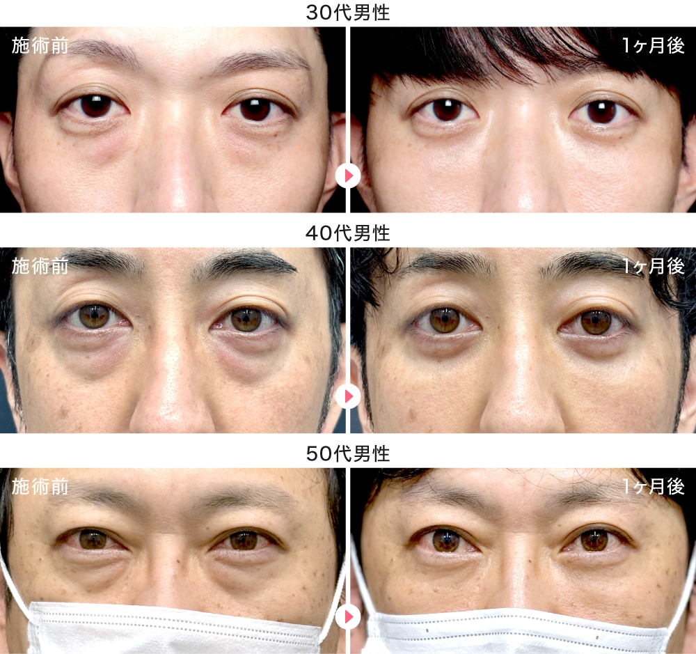 男性症例